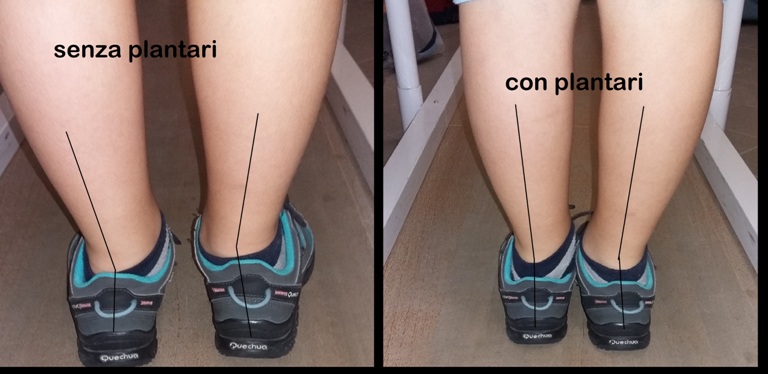 scarpe per piedi piatti adulti